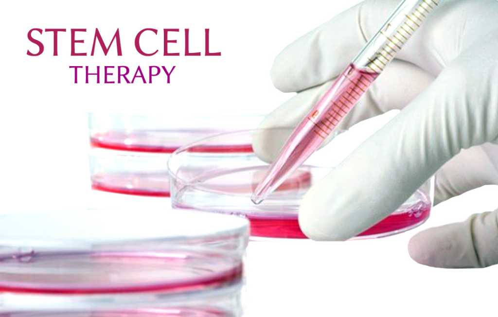 Stem cell Therapy